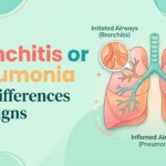 Bronchitis or Pneumonia